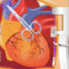 Heart Surgery 2 Image