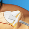 Virtual Nose Job Surgery Image
